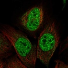 Immunofluorescent staining of human cell line U-2 OS shows localization to nuclear speckles.