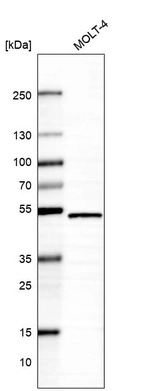 Anti-NARF Antibody