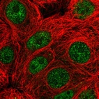 Anti-PARG Antibody