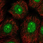Immunofluorescent staining of human cell line MCF7 shows localization to nucleus & nucleoli.