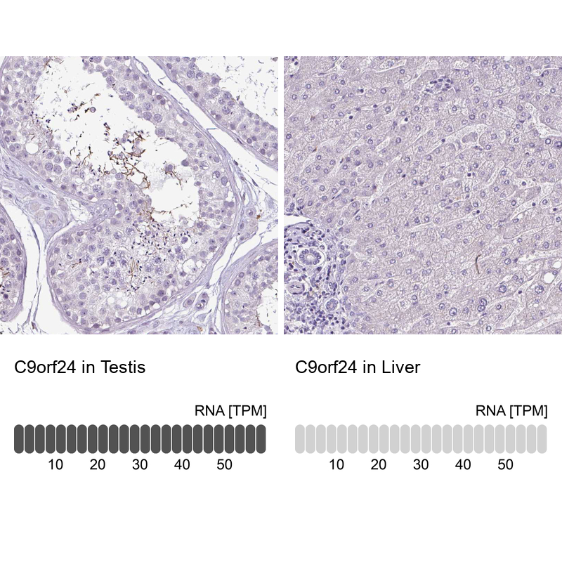 Anti-C9orf24 Antibody