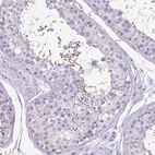 Immunohistochemical staining of human Testis shows moderate cytoplasmic positivity in spermatids.