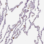 Immunohistochemical staining of human Lung shows moderate cytoplasmic positivity in macrophages.