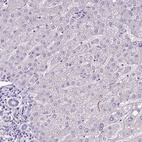 Immunohistochemical staining of human Liver shows no positivity in hepatocytes as expected.