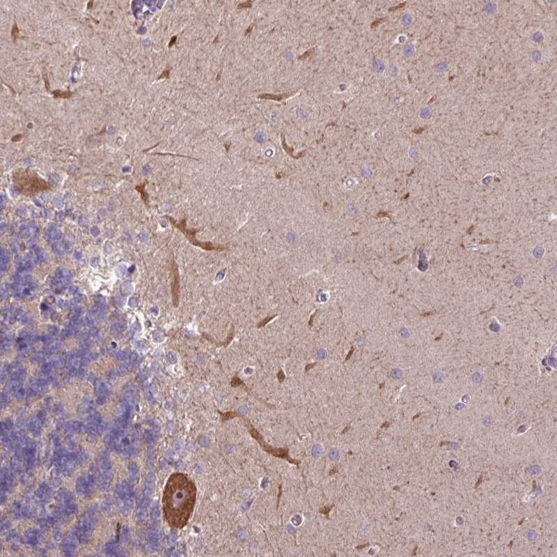 Anti-L3MBTL3 Antibody
