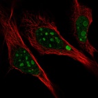 Immunofluorescent staining of human cell line U-2 OS shows localization to nucleoli.