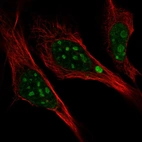 Immunofluorescent staining of human cell line U-2 OS shows localization to nucleoli.