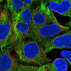 Immunofluorescent staining of human cell line HEK 293 shows localization to cytosol.