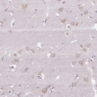 Anti-SYBU Antibody