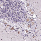 Immunohistochemical staining of human cerebellum shows moderate cytoplasmic positivity in Purkinje cells.