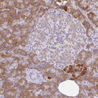 Immunohistochemical staining of human pancreas shows moderate cytoplasmic positivity in exocrine glandular cells.