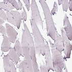 Immunohistochemical staining of human skeletal muscle shows no positivity in myocytes as expected.