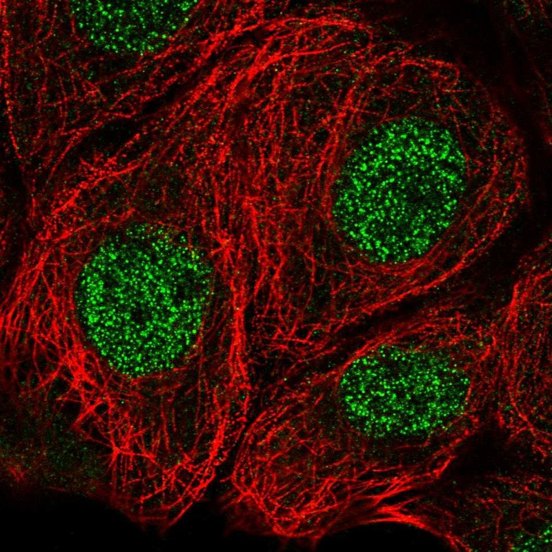 Anti-MSRA Antibody