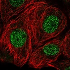 Anti-MSRA Antibody
