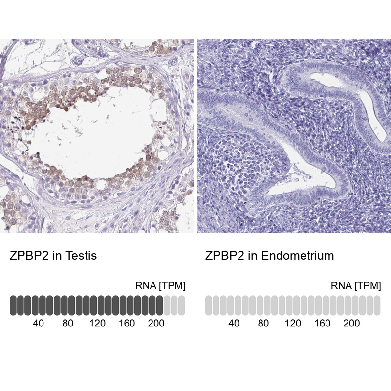 Anti-ZPBP2 Antibody