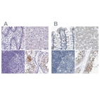 Immunohistochemical staining of human colon, liver, lymph node and testis using Anti-ZPBP2 antibody HPA053070 (A) shows similar protein distribution across tissues to independent antibody HPA027997 (B).