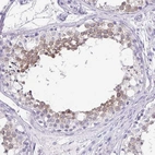 Immunohistochemical staining of human testis shows high expression.