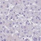 Immunohistochemical staining of human liver using Anti-ZPBP2 antibody HPA053070.