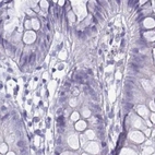 Immunohistochemical staining of human colon using Anti-ZPBP2 antibody HPA053070.
