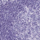 Anti-ZPBP2 Antibody