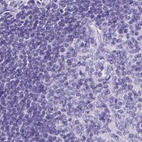 Immunohistochemical staining of human lymph node using Anti-ZPBP2 antibody HPA053070.