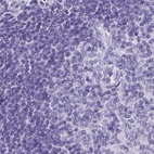 Immunohistochemical staining of human lymph node using Anti-ZPBP2 antibody HPA053070.