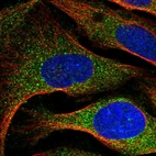 Anti-ARMC7 Antibody
