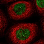Immunofluorescent staining of human cell line A-431 shows localization to nucleoplasm & nuclear bodies.