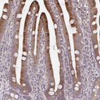 Anti-OSBPL7 Antibody