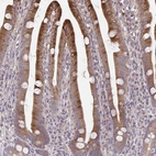 Anti-OSBPL7 Antibody