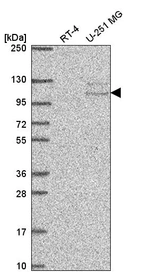 Anti-TSR1 Antibody
