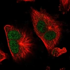 Immunofluorescent staining of human cell line U-251 MG shows localization to nucleoplasm.
