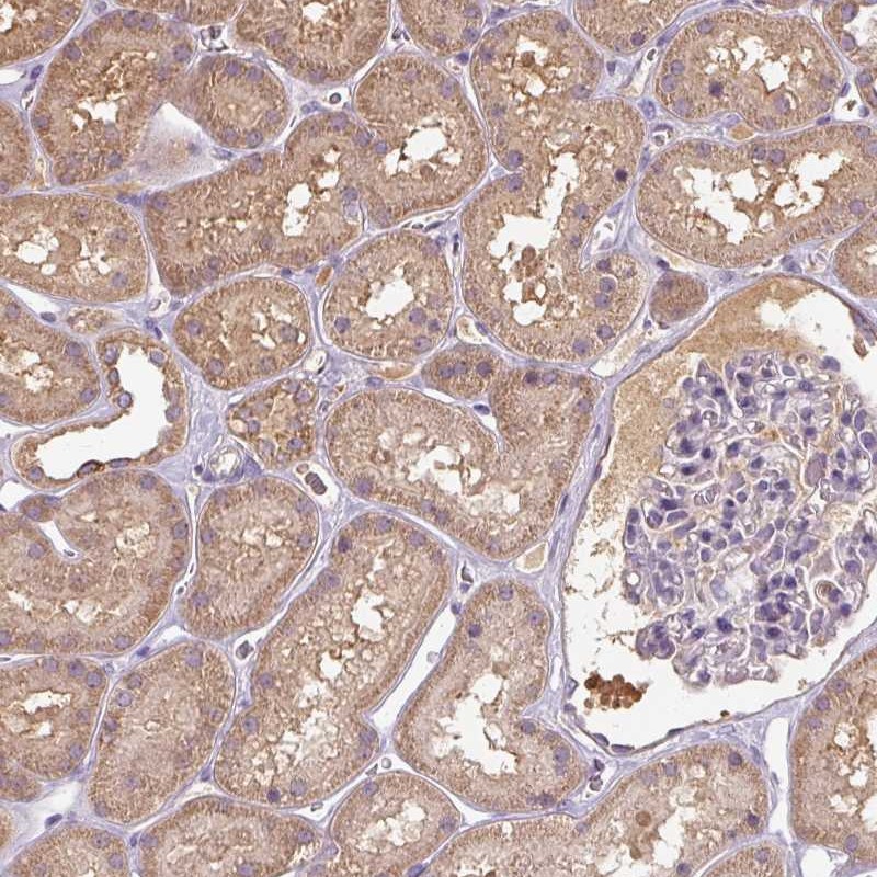 Anti-TSEN54 Antibody