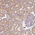 Anti-TSEN54 Antibody