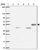 Lane 1: Marker [kDa] 250, 130, 95, 72, 55, 36, 28, 17, 10_br/_Lane 2: Human cell line RT-4_br/_Lane 3: Human cell line U-251MG sp_br/_Lane 4: Human plasma (IgG/HSA depleted)_br/_Lane 5: Human liver tissue_br/_Lane 6: Human tonsil tissue