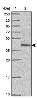 Lane 1: Marker [kDa] 250, 130, 95, 72, 55, 36, 28, 17, 10_br/_Lane 2: Human cell line RT-4