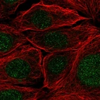 Immunofluorescent staining of human cell line MCF7 shows localization to nucleus & nuclear membrane.