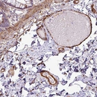 Immunohistochemical staining of human colon shows strong cytoplasmic positivity in endothelial cells.