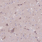 Immunohistochemical staining of human cerebral cortex shows moderate cytoplasmic positivity in endothelial cells.