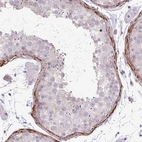 Immunohistochemical staining of human testis shows strong cytoplasmic positivity in peritubular myoid cells.