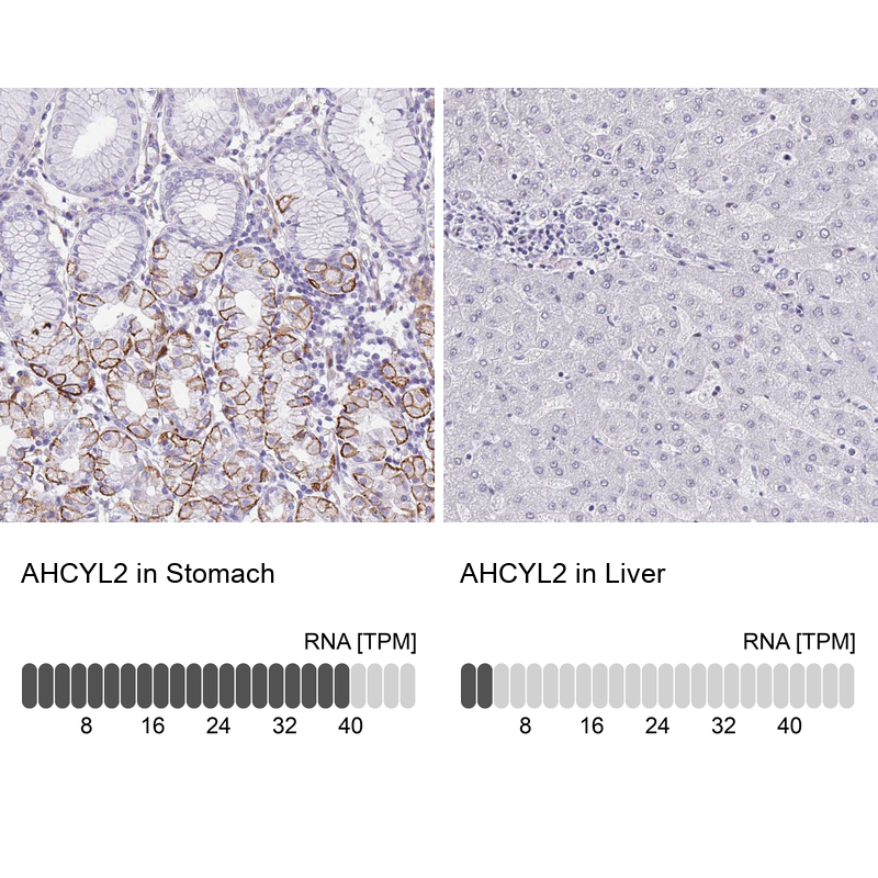 Anti-AHCYL2 Antibody