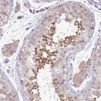 Immunohistochemical staining of human testis shows moderate positivity in a subset of cells in seminiferous ducts.