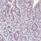 Immunohistochemical staining of human small intestine shows weak cytoplasmic positivity in glandular cells.