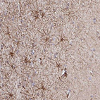 Anti-DNAL1 Antibody