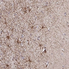 Immunohistochemical staining of human cerebral cortex shows moderate positivity in astrocytes.