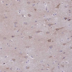 Immunohistochemical staining of human cerebral cortex shows weak to moderate cytoplasmic positivity in neurons.
