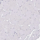 Immunohistochemical staining of human skeletal muscle shows no positivity in myocytes as expected.