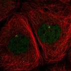 Immunofluorescent staining of human cell line A-431 shows localization to nucleoplasm & microtubule organizing center.