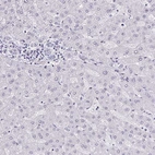 Immunohistochemical staining of human liver shows no positivity in hepatocytes as expected.