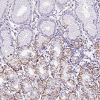 Immunohistochemical staining of human stomach shows moderate to strong membranous positivity in parietal cells.